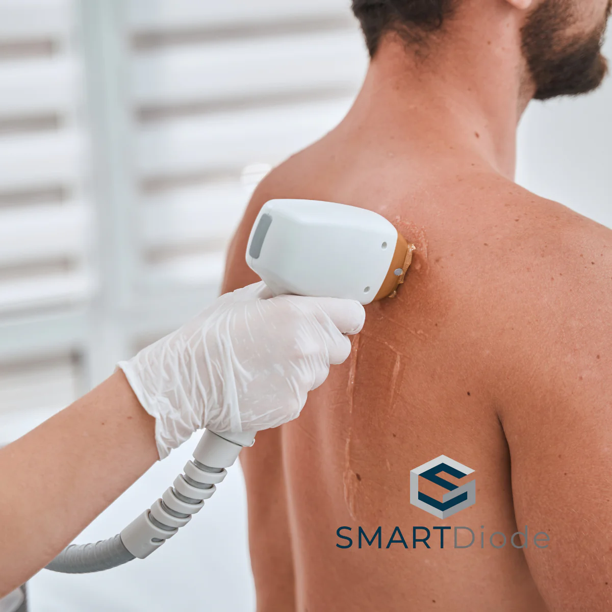 Laser Hair Removal Package - Chest, Abs & Back - Image 3